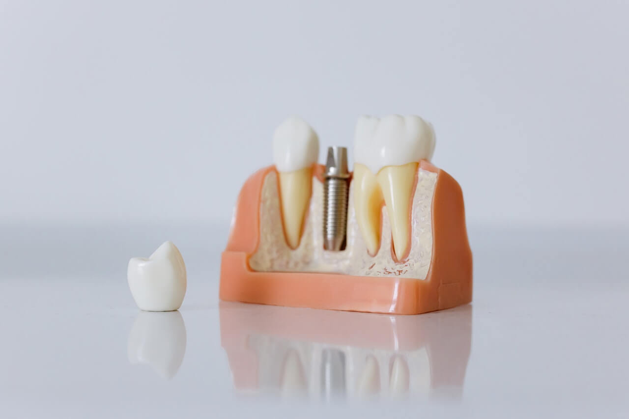 Budowa zęba człowieka